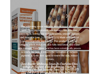 Dark Knuckle Whitening Serum In Rivière-Salée Town in Martinique Call +27710732372 Get Rid Of Vitiligo In Lake Helen City in Florida